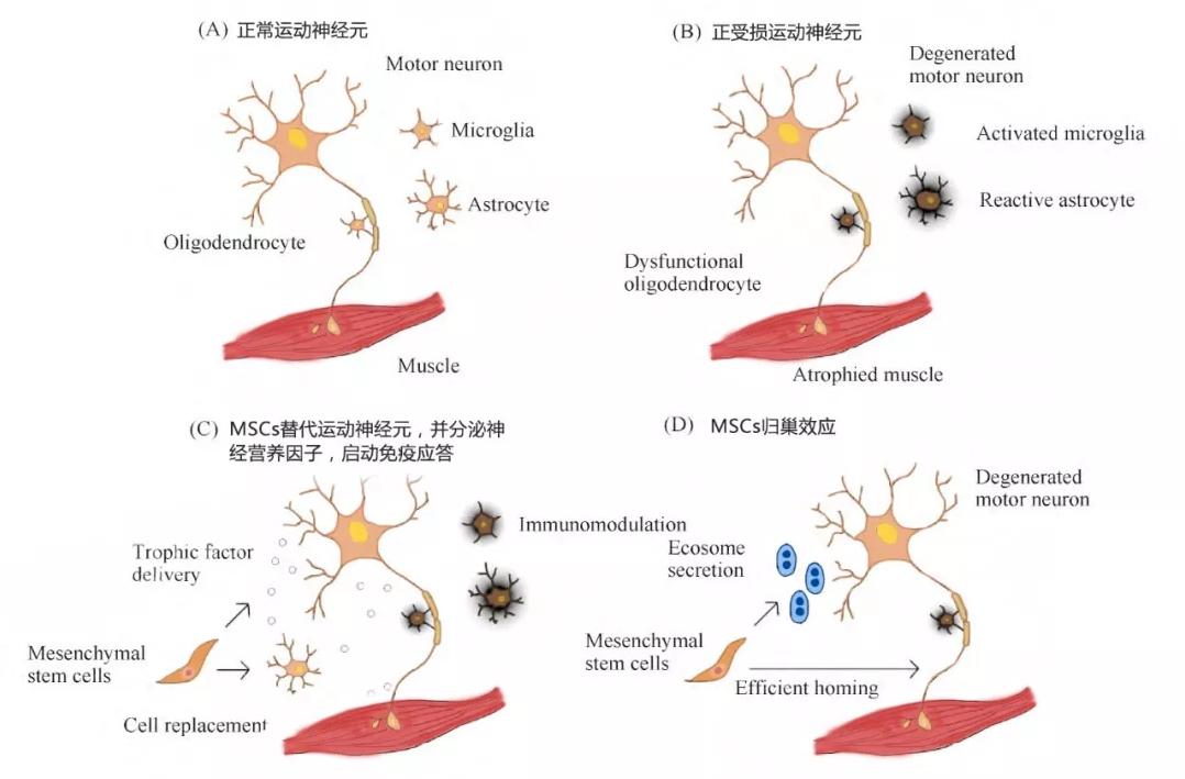 干細(xì)胞療法調(diào)理ALS作用機(jī)制