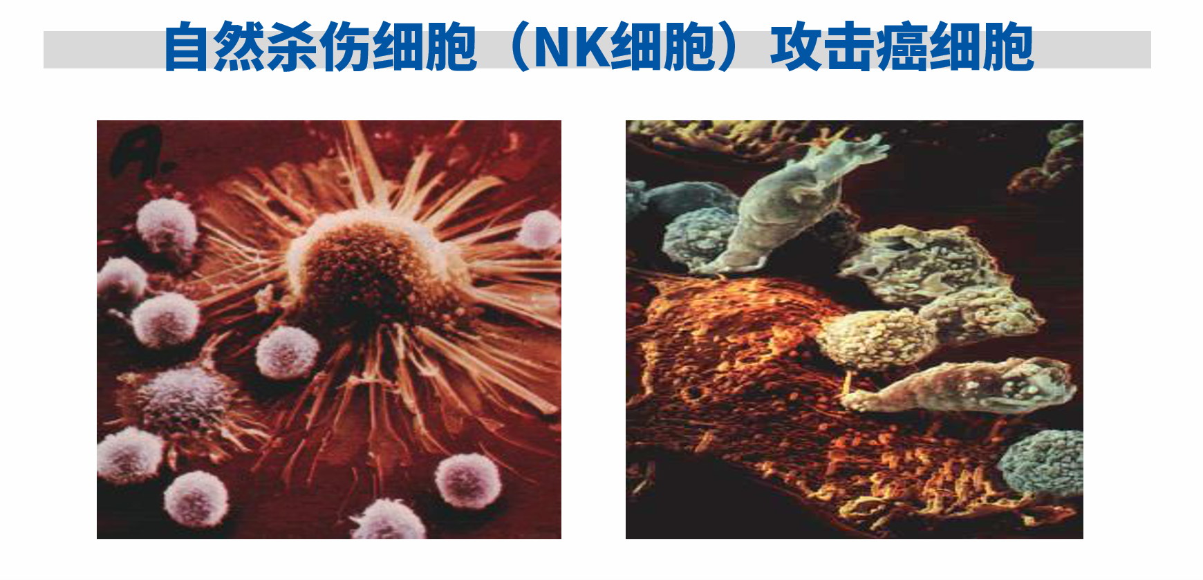 nk細胞攻擊癌細胞