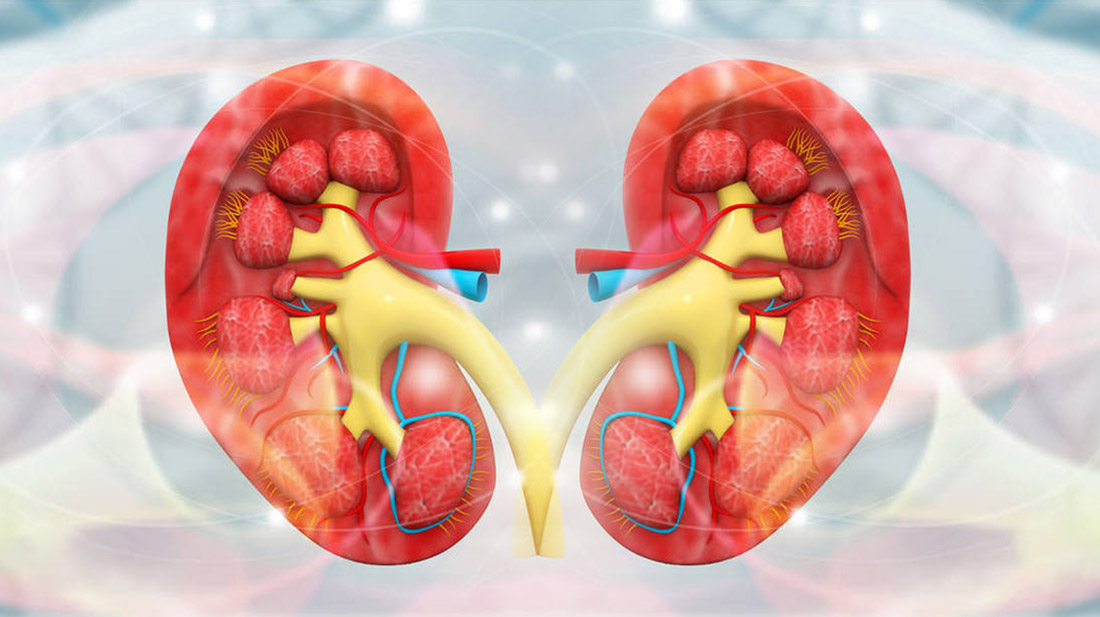 12例干細(xì)胞移植狼瘡性腎炎中的研究