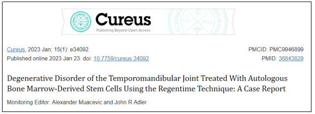 Cureus期刊最新報(bào)道：干細(xì)胞治療1例下頜關(guān)節(jié)退行性疾病，隨訪顯示完全康復(fù)